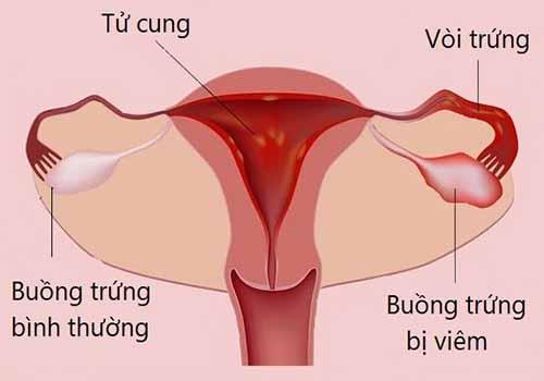 viem-buong-trung.jpg