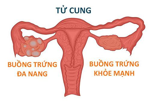 buong-trung-da-nang-2.jpg
