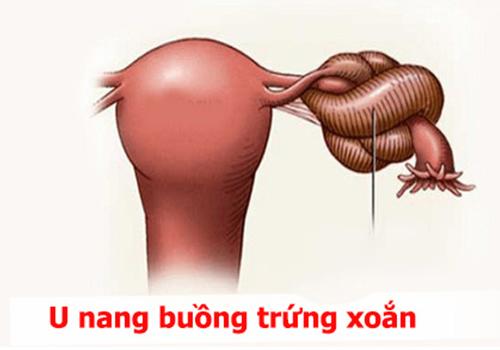 xoan-nang.jpg