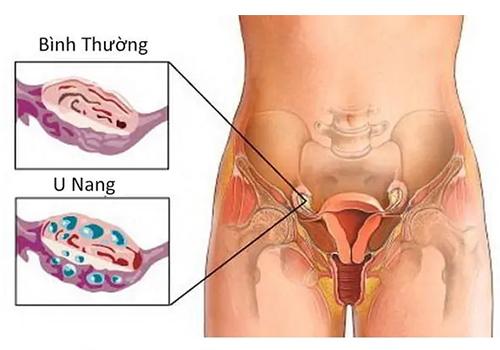 u-nang-buong-trung-2.jpg