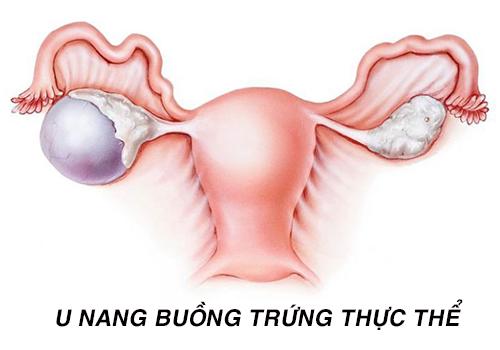 U-nang-buong-trung-thuc-the.jpg