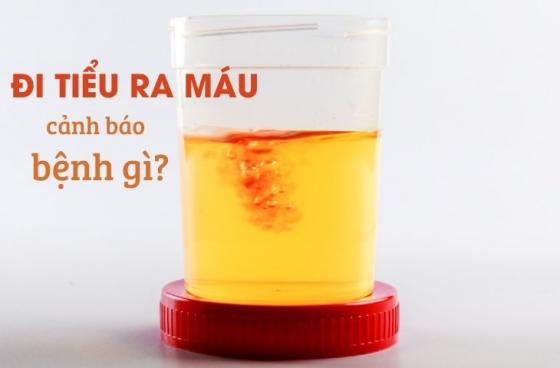 di-tieu-ra-mau_833.jpg